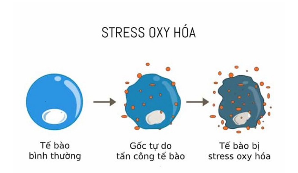 Mất cân bằng oxi hoá